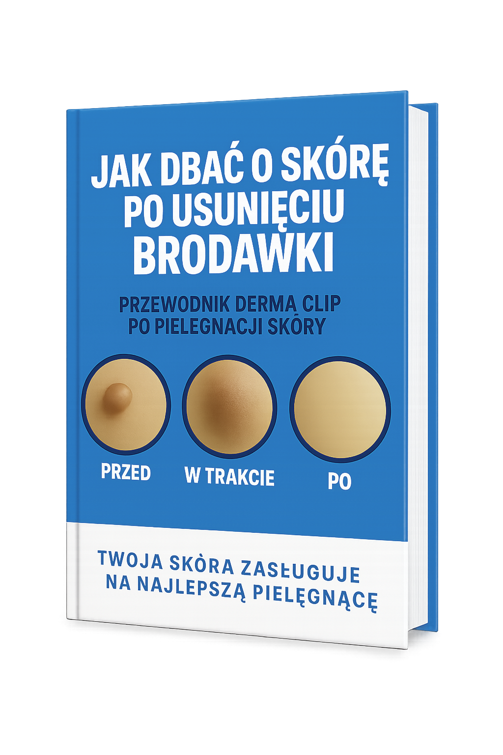Ebook "Jak zadbać o skórę po usunięciu brodawki"