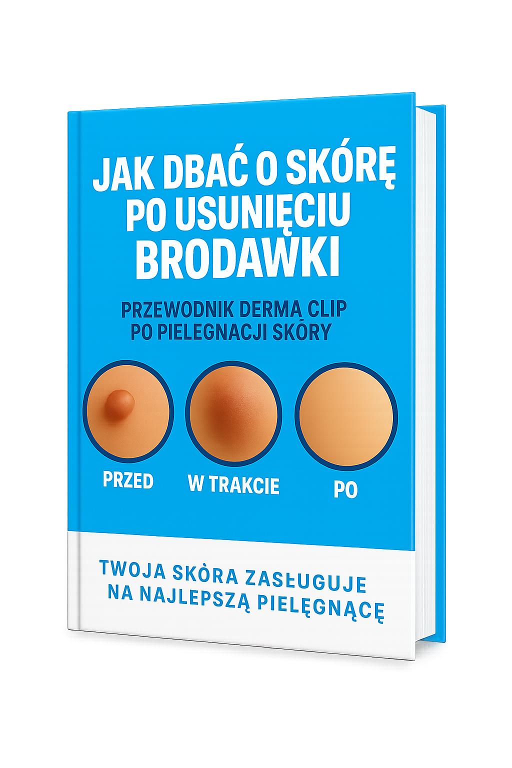 Ebook "Jak zadbać o skórę po usunięciu brodawki"