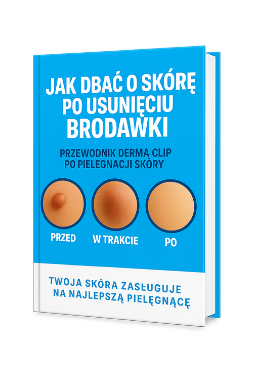 Ebook "Jak zadbać o skórę po usunięciu brodawki"