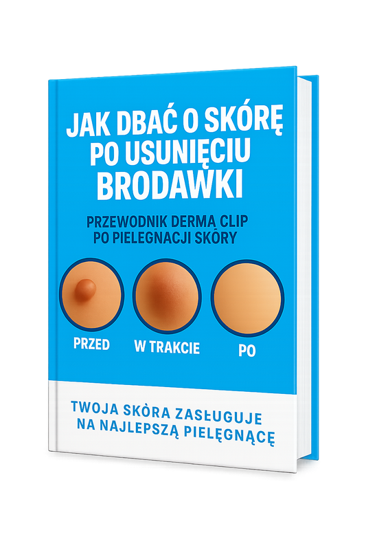 Ebook "Jak zadbać o skórę po usunięciu brodawki"