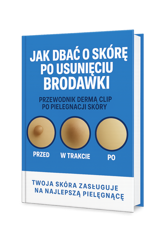 Ebook "Jak zadbać o skórę po usunięciu brodawki"